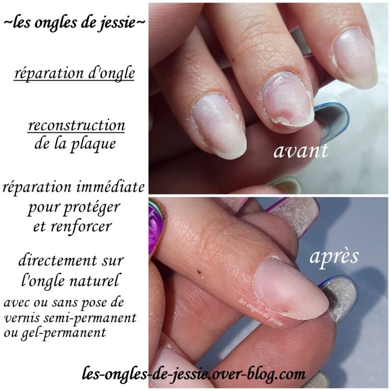 Avant / Après : Retrouver une forme harmonieuse