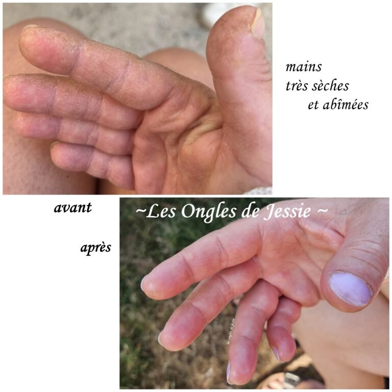 Avant / Après : Retrouver des mains douces