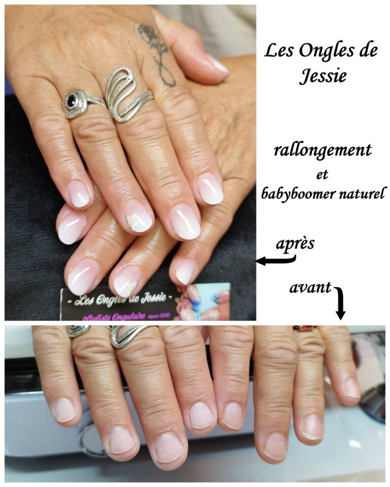 Avant / Après : Rallongement ongles courts et plats – babyboomer blanc naturel